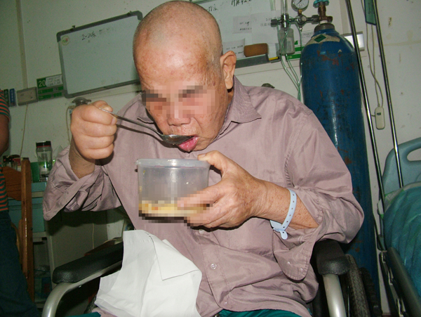 中西医结合双管齐下80高龄严重吞咽障碍老人再次正常进食