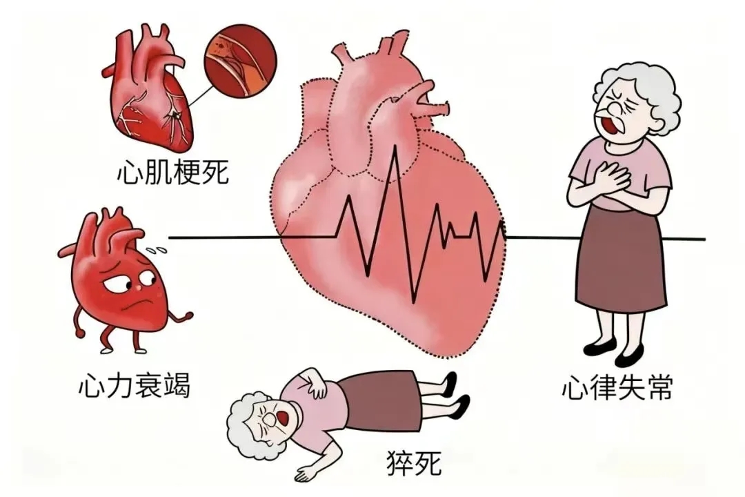叮嘱爸妈：记住这三点，让心血管平安过冬